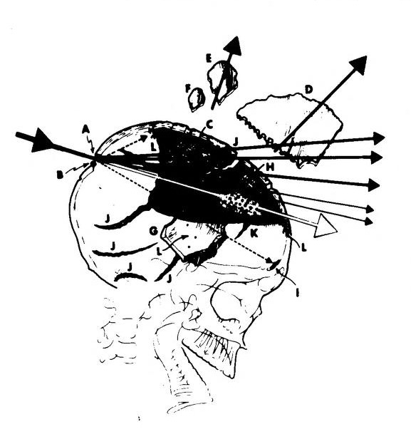 Lattimer, skull diagram