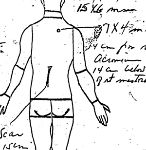 JFK, back wound, diagram