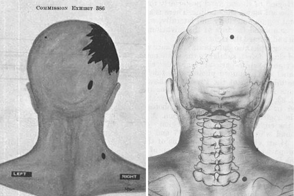 JFK Assassination: The Tell-Tale Brain - WhoWhatWhy