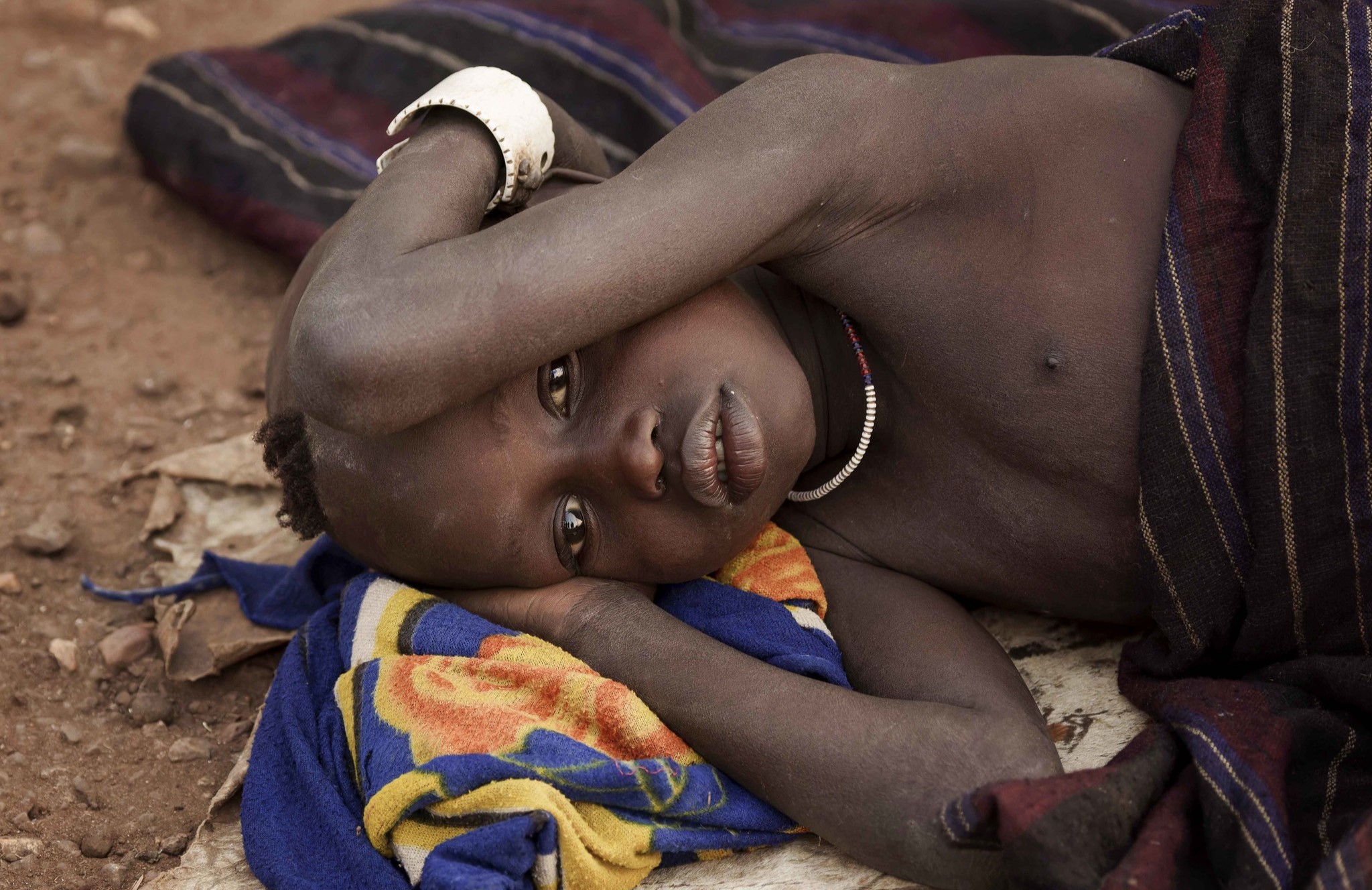 child, malaria, ethiopia