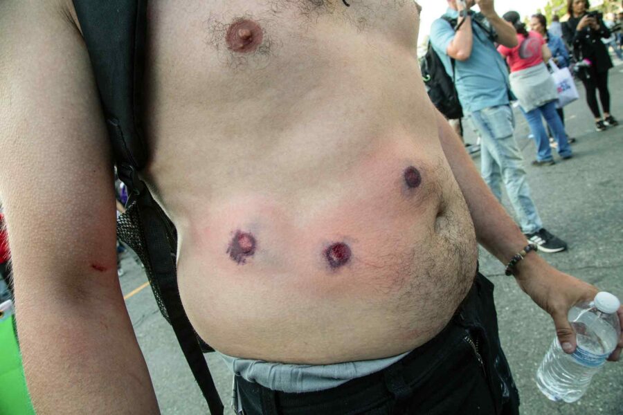 LA, Los Angeles, anti-ICE protester, hit by projectiles